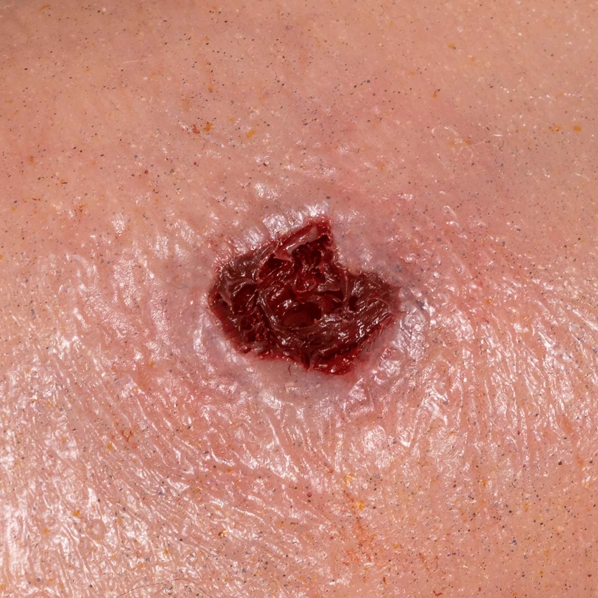 Close up of wound texture